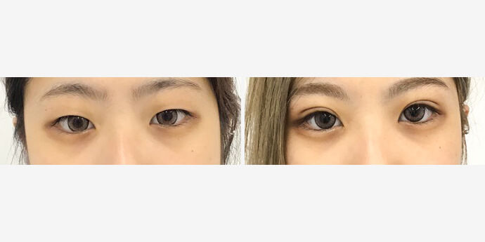 東郷美容形成外科福岡