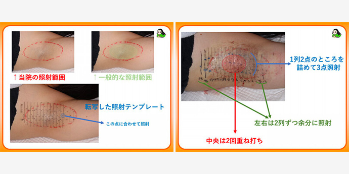 こまちくりにっく