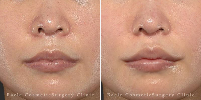 新宿ラクル美容外科クリニック