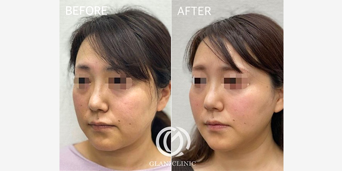 GLANZ CLINIC （グランツクリニック）