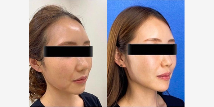 銀座長瀬クリニック銀座院・大坂院 La Clinique Ginza