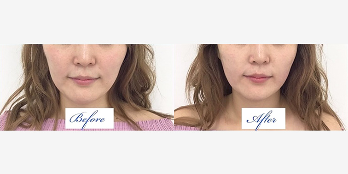 東郷美容形成外科福岡