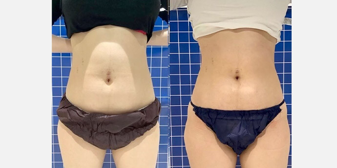 銀座長瀬クリニック