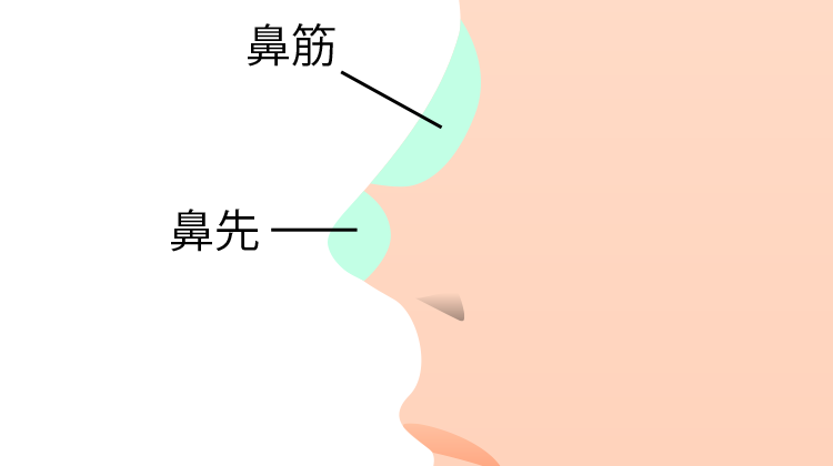 ヒアルロン酸・レディエッセ注入