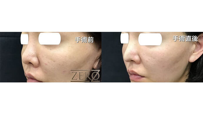 東京ゼロクリニック銀座