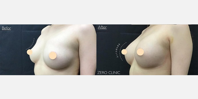 東京ゼロクリニック銀座