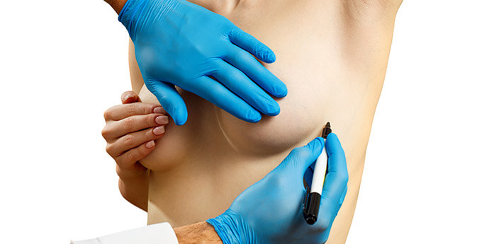 ヒアルロン酸注入豊胸術