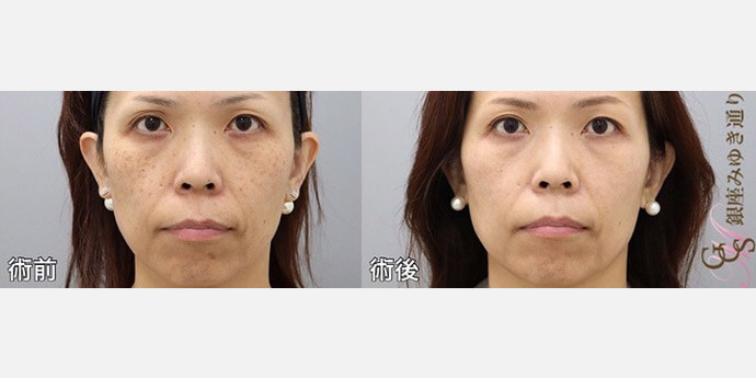 銀座みゆき通り美容外科