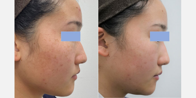 静岡美容外科橋本クリニック