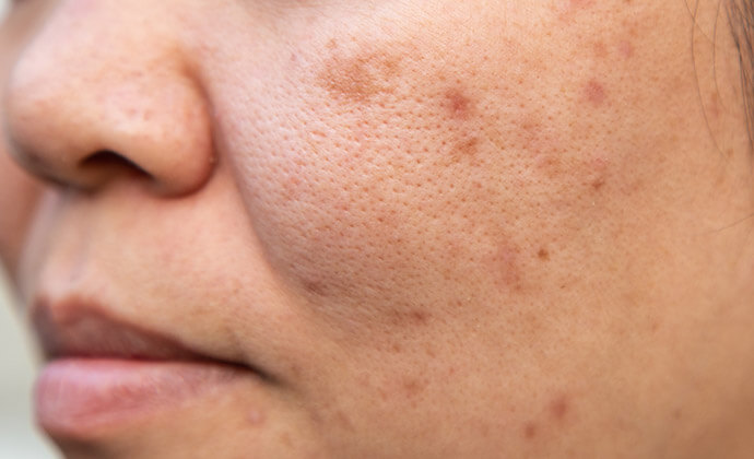 複数の目立つシミ