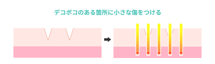 デコボコのある箇所に小さな傷をつける