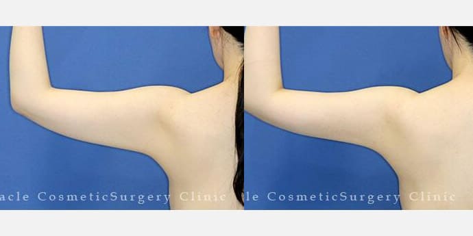 新宿ラクル美容外科クリニック