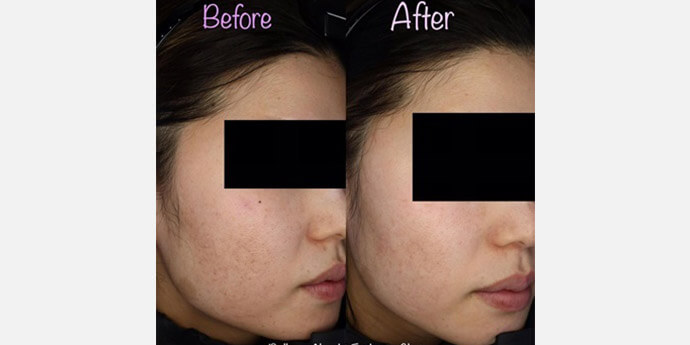 ベレッサ明石美容クリニック