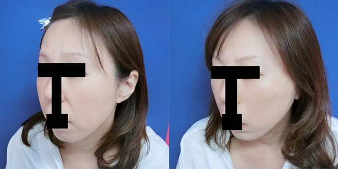 グローバルビューティークリニック