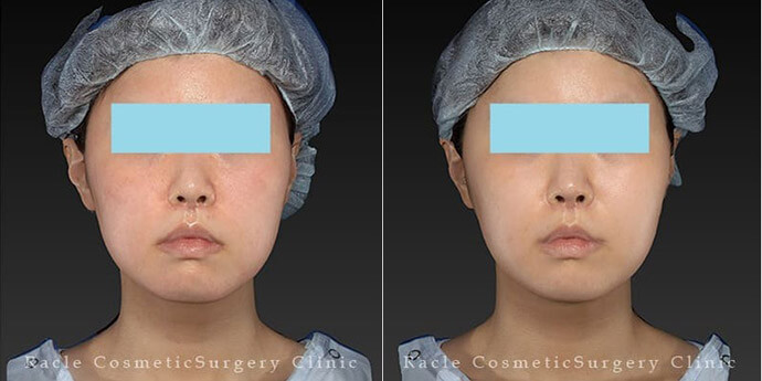 新宿ラクル美容外科クリニック