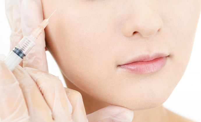 ヒアルロン酸注入