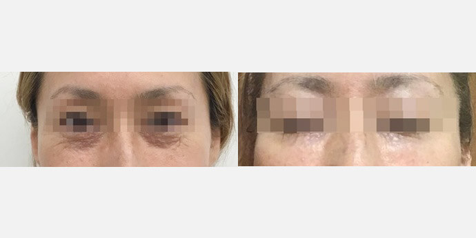 東郷美容形成外科福岡