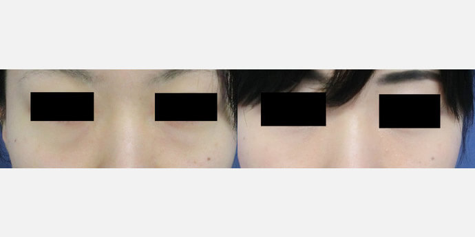 グローバルビューティークリニック