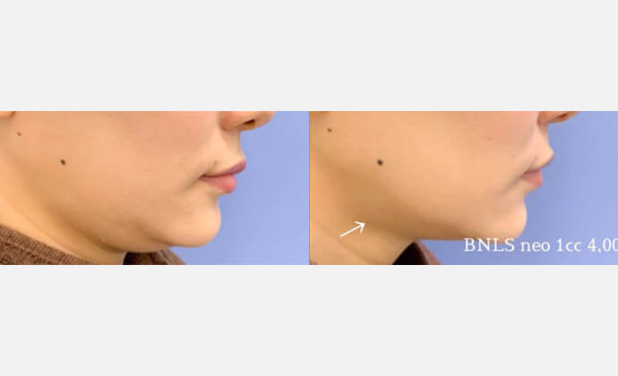 東京八丁堀皮膚科・形成外科の症例画像