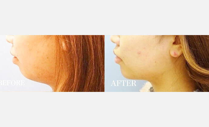 表参道スキンクリニックの症例画像