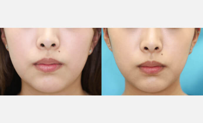 大塚美容形成外科 東京大塚院の症例画像