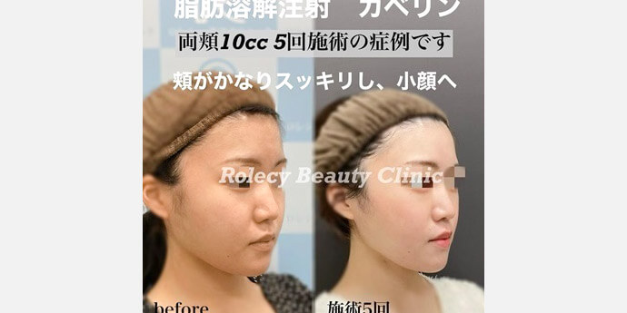 ロレシー美容クリニック