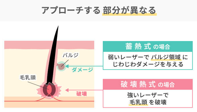 他の脱毛との比較