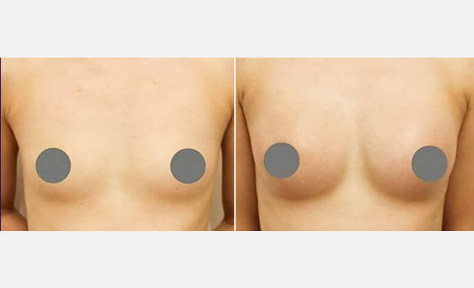 症例：広島プルミエクリニック