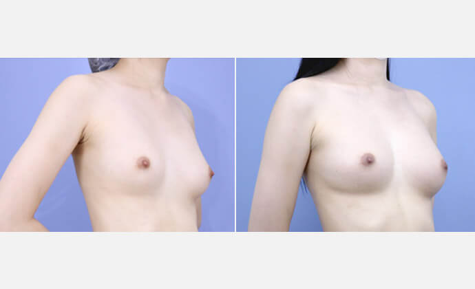 症例：湘南美容クリニック 新宿本院