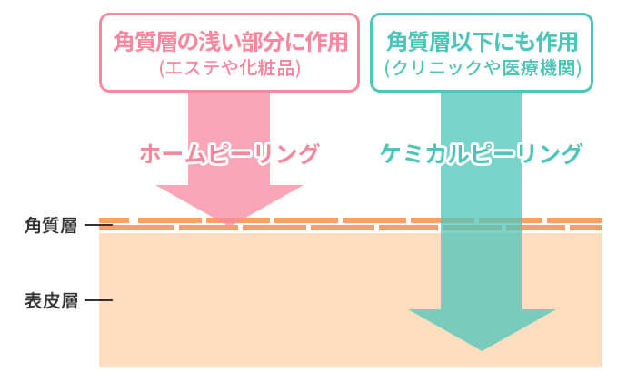 ホームピーリングとケミカルピーリングの違い