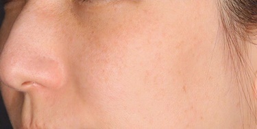 セレクトクリニック（SELECT CLINIC） 表参道院