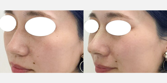 東郷美容形成外科福岡