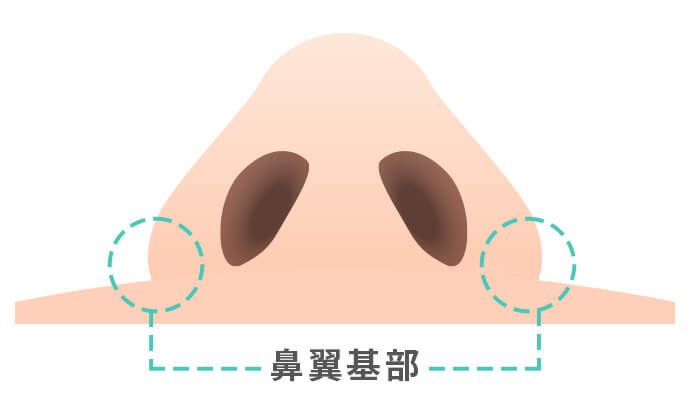 鼻翼基部