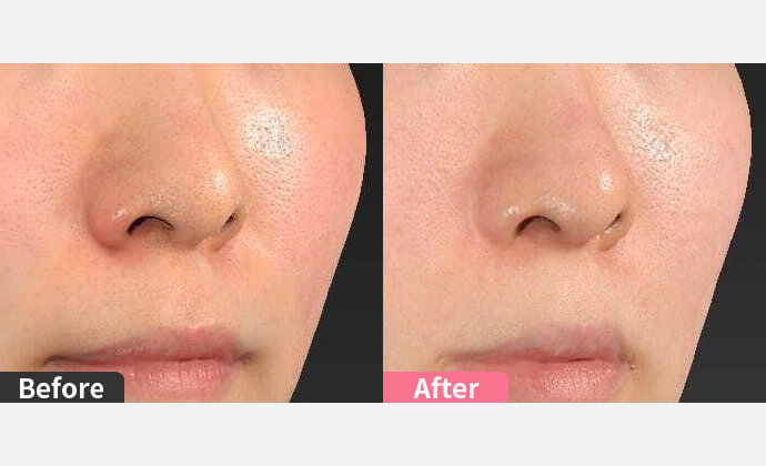 SNSで密かに話題の「貴族整形」とは？