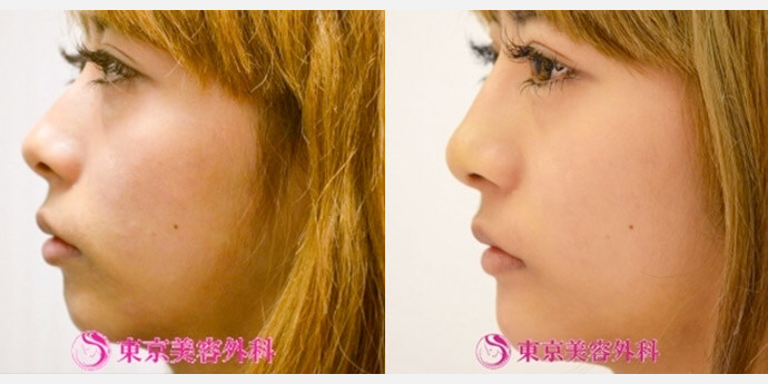 東京美容外科