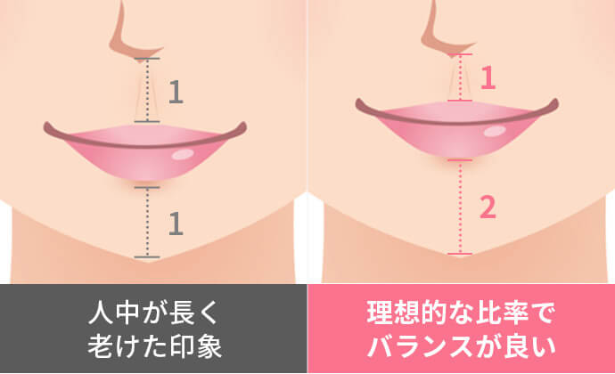 人中短縮って？