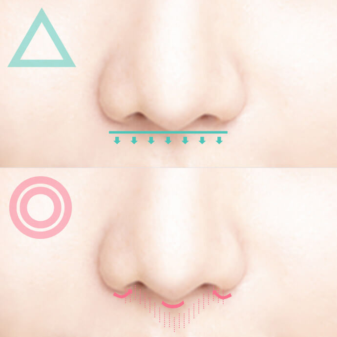 傷跡を最小限におさえられるか