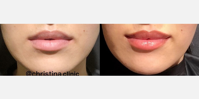 クリスティーナクリニック銀座