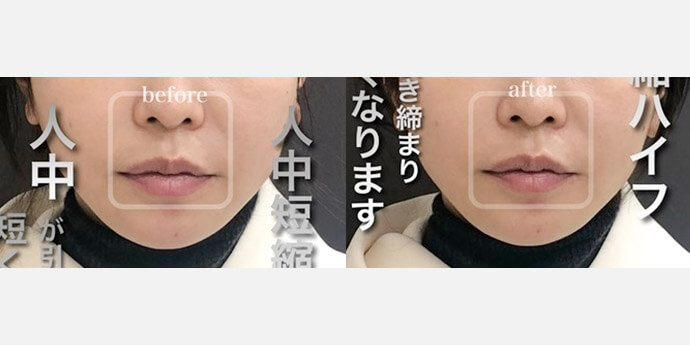 ロレシー美容クリニック