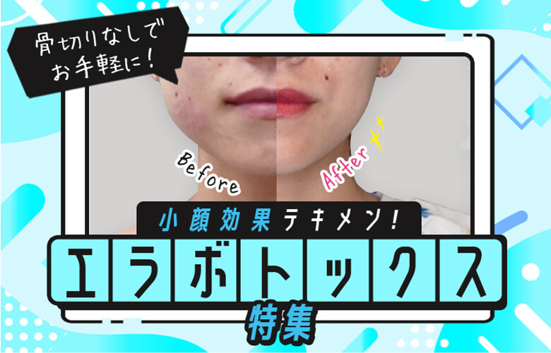 効果テキメン！ 小顔エラボトックス注射　おすすめクリニック＆プラン