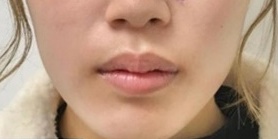 ルラ（LULA）美容クリニック