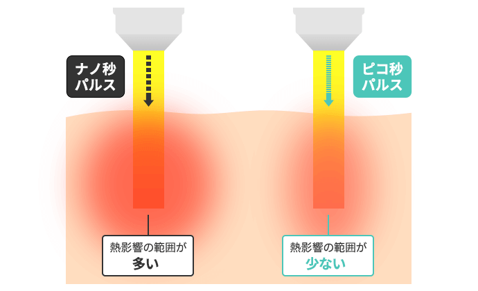従来のレーザーとピコレーザーとの違い