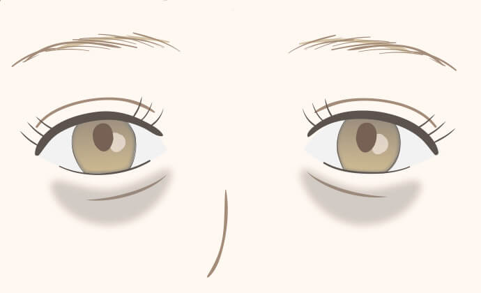 黒クマ・影くま