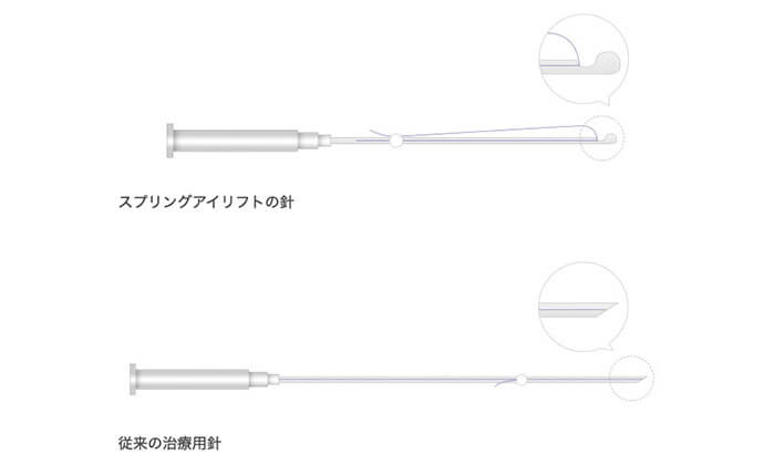 アイリフトの針