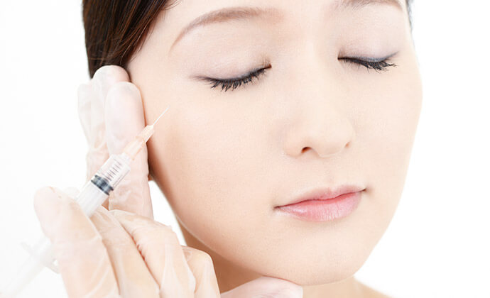 ボトックス（ボツリヌス菌注射）