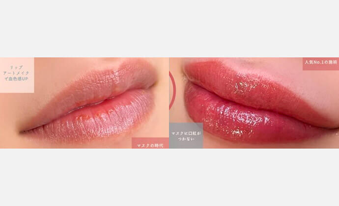 アートメイクの症例