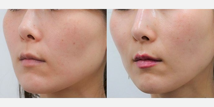 静岡美容外科橋本クリニック