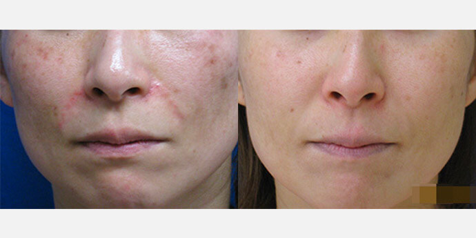 ハートライフクリニック