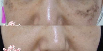 表参道美容皮膚科原宿本院