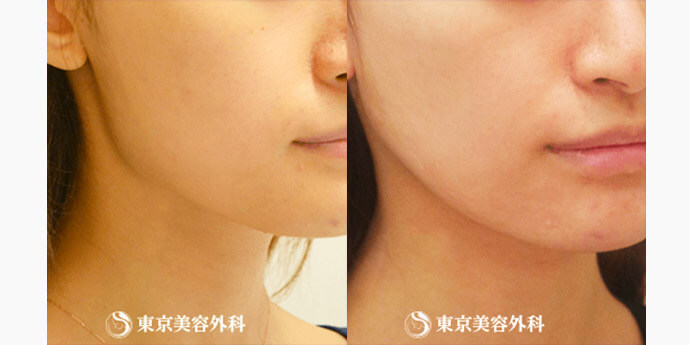 東京美容外科